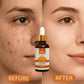 Relax Vitamin C Daily Serum | Skin Brightening Serum