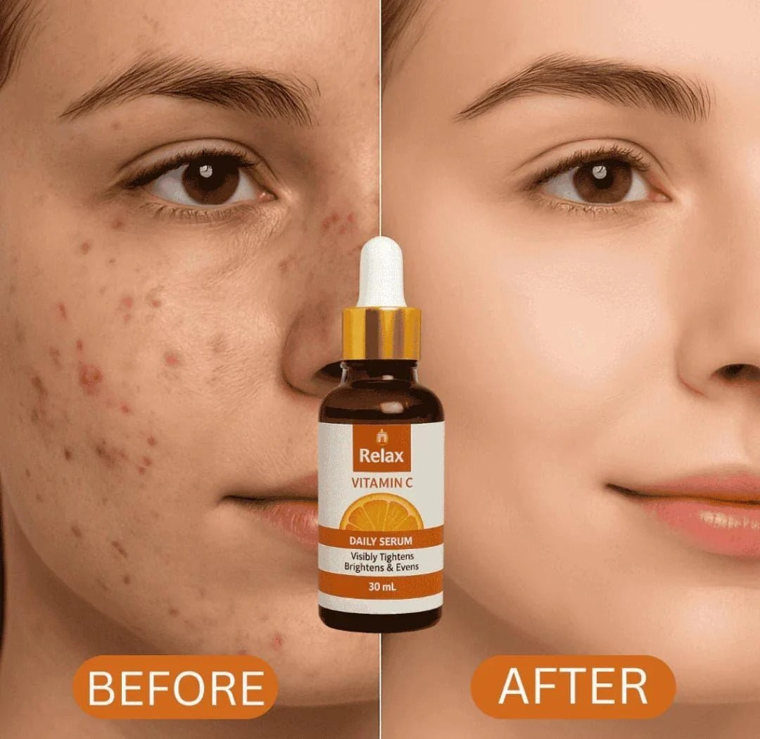 Relax Vitamin C Daily Serum | Skin Brightening Serum